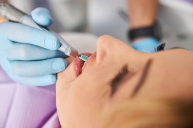 Prophy bardağı dişlerin dişlerine değiyor.