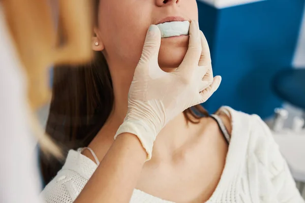 Paciente mordendo no molde moldado da mandíbula, realizada pelo dentista — Fotografia de Stock