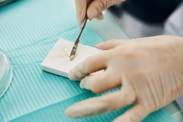 Dental cement mix turning into solid filling under spatula — Stock Photo, Image