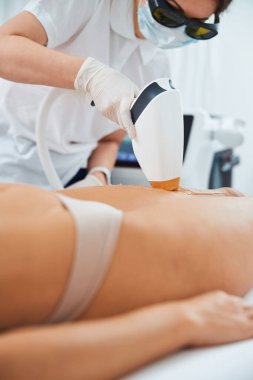 Profesyonel dermatolog hasta bacaklarında lazer tüyü temizliyor.