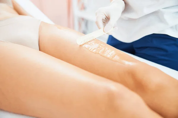 Dermatolog kadın bacağındaki fazla jöleyi alıyor. — Stok fotoğraf