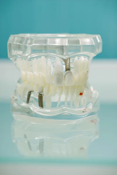 Arbeit des Zahnarztes ist nicht so einfach — Stockfoto