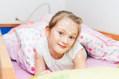 Little girl of 7 years old with chicken pox resting in a bed clipart