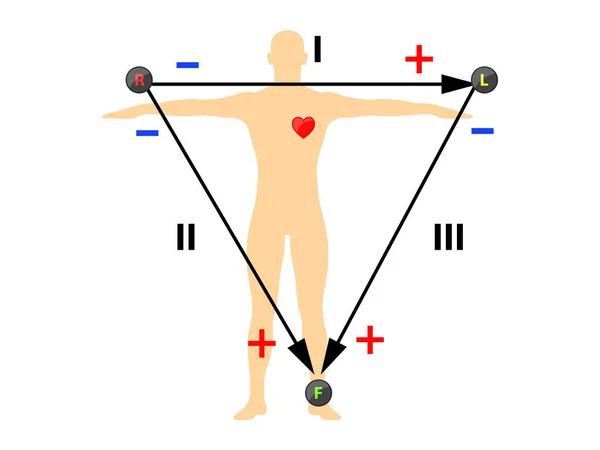 Triângulo Eletrocardiográfico Incluindo Ilustração Aumentada Eletrodo Unipolar Membro — Fotografia de Stock