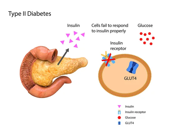 Schematyczna Ilustracja Trzustki Żołądka Stężeniu Insuliny Glukozy Krwi Grafika Ilustracja — Zdjęcie stockowe