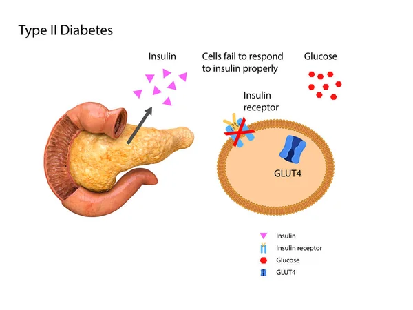 Ilustración Esquemática Del Páncreas Estómago Los Niveles Insulina Glucosa Sangre —  Fotos de Stock