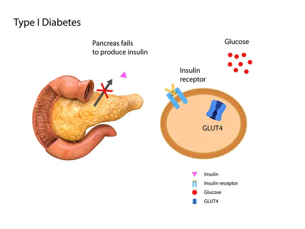 Ilustración Esquemática Del Páncreas Estómago Los Niveles Insulina Glucosa Sangre — Foto de Stock