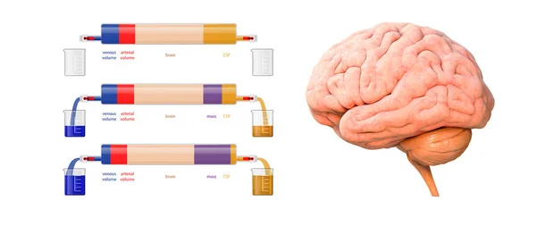 Cervello Massa Volume Arterioso Volume Venoso Csf Acronimo Liquido Cerebrospinale — Foto Stock