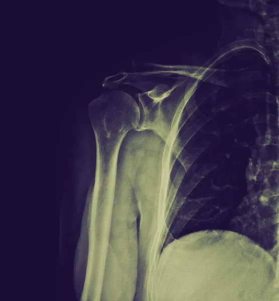 Retro-look xray — Stockfoto