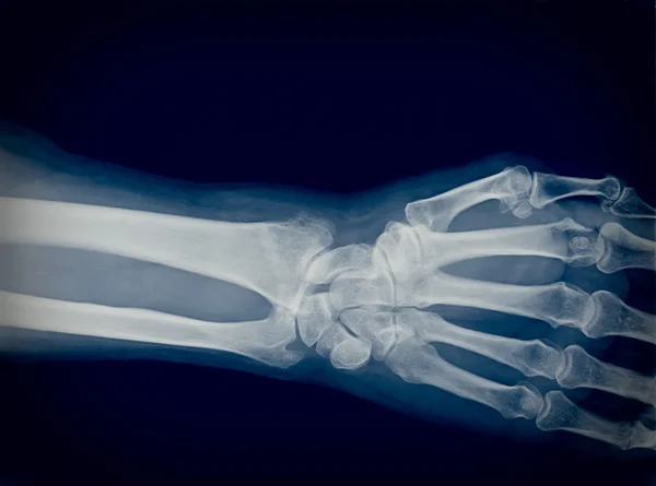 Xray — Stock Photo, Image