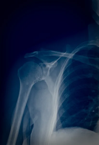 Xray — Stock Photo, Image