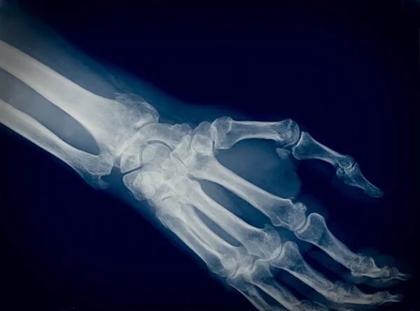 Xray — Stock Photo, Image