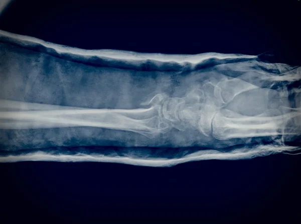Рентген — стоковое фото