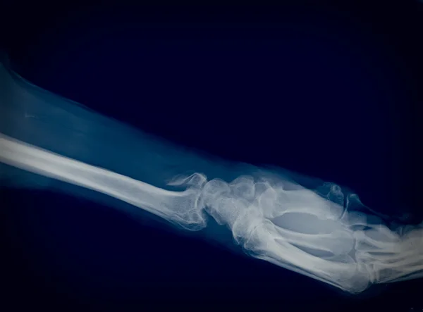 Xray — Stock Photo, Image