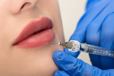 Kozmetik uzmanının elleri yüzüne ve dudaklarına iğne yapıyor. Genç bir kadın güzellik salonunda yüz aşısı yaptırıyor. Yaşlanma, gençleşme ve hidrasyon prosedürleriyle yüzleş. Estetik kozmetoloji. Kapat..