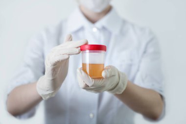 Elinde idrar analizi olan doktor ya da hemşire elleri. Yaklaş, seçici odaklanma.