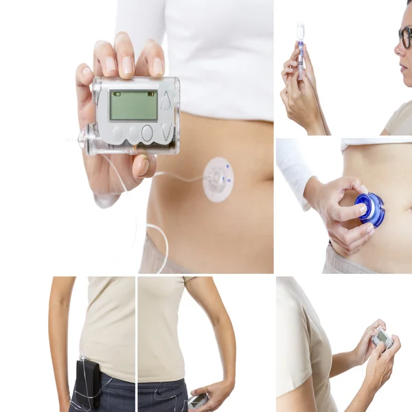 Insulin pump collage — Stock Photo, Image