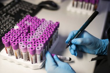 Moskova, Rusya - 20 Mayıs 2021, Koronavirüsün tespiti için PCR testlerinin yapıldığı laboratuvarda test tüpleri