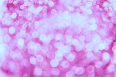 Bokeh soyut ışık arkaplanı