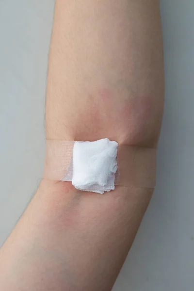 Frauenhand Mit Baumwollalkohol Arm Nach Blutspende Auf Weißem Rücken Geschlossen — Stockfoto