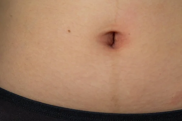 Navel Magen Kvinna Med Svarta Underkläder — Stockfoto