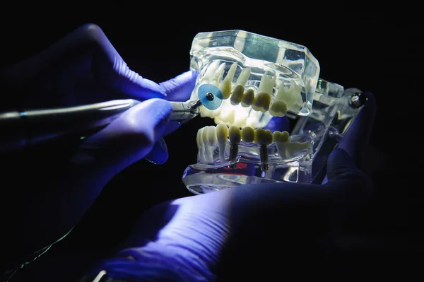 Dentist demonstrates how to polish teeth with a toothbrush