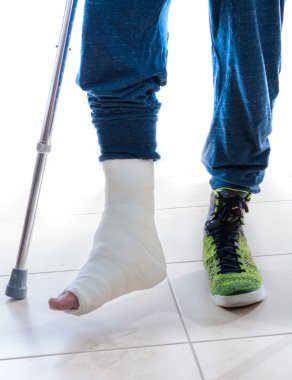 Kırık bir bilekle ve döküm bacak ile genç adam