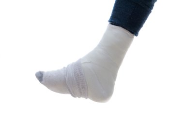 Bacak döküm bir çorap ile kaplı 