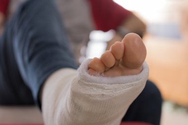 Kırık bir bilekle ve döküm bacak ile genç adam