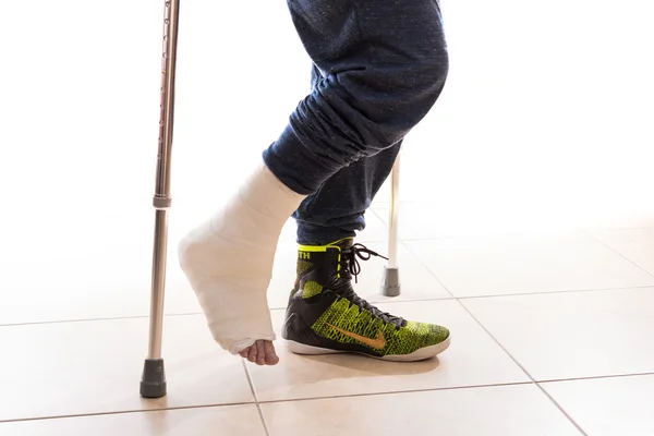 Молодий чоловік з розбитими щиколотками і відлитою ногою — стокове фото