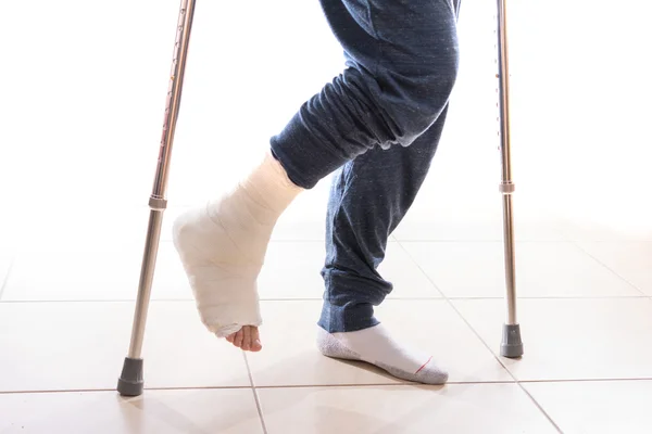 Young man with a broken ankle and a leg cast — Stock Photo, Image