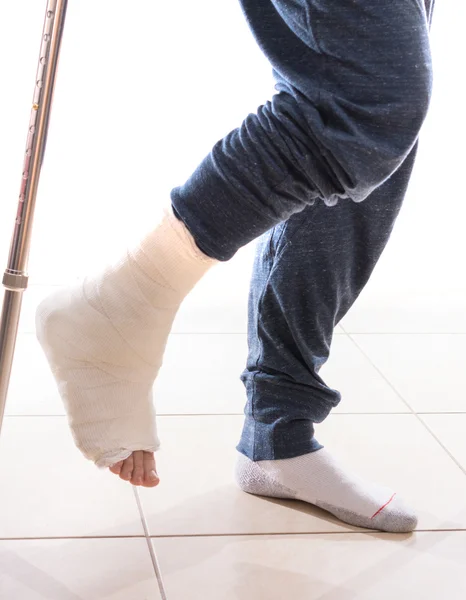 Молодой человек со сломанной лодыжкой и слепленной ногой — стоковое фото