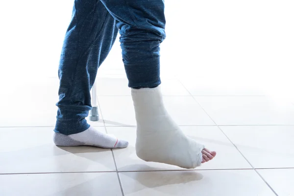 Junger Mann mit gebrochenem Knöchel und Gips — Stockfoto