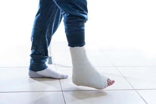 Young man with a broken ankle and a leg cast — Stock Photo, Image