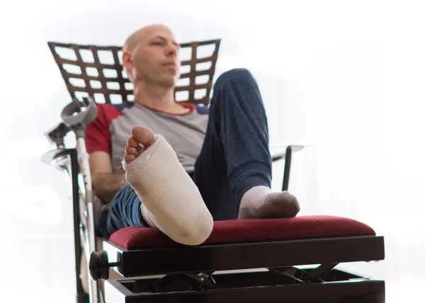 足首を骨折とキャスト脚と若い男 — ストック写真