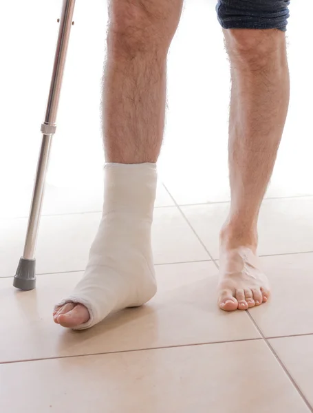Jovem com um tornozelo quebrado e uma perna moldada — Fotografia de Stock