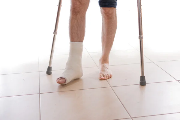 Jeune homme avec une cheville cassée et une jambe coulée — Photo