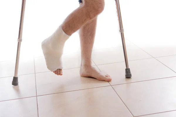 Young man with a broken ankle and a leg cast — Stock Photo, Image