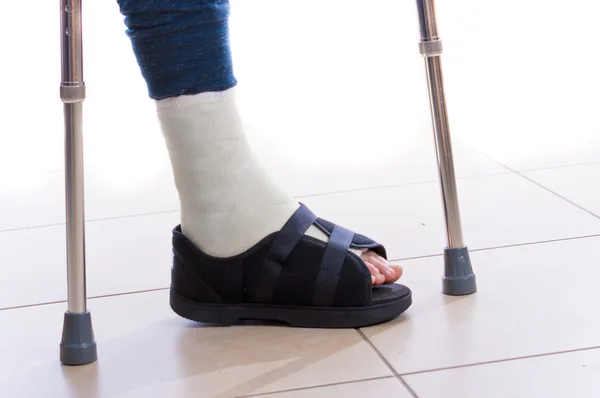 Молодой человек со сломанной лодыжкой и слепленной ногой — стоковое фото