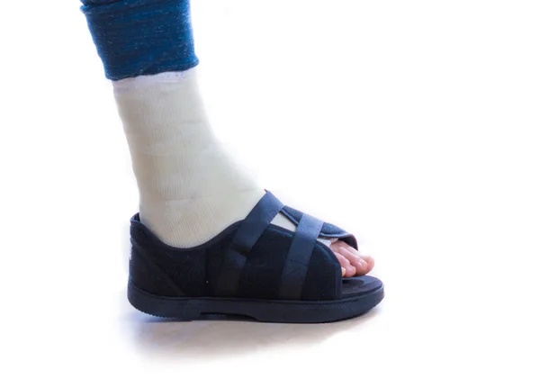 Jovem com um tornozelo quebrado e uma perna moldada — Fotografia de Stock