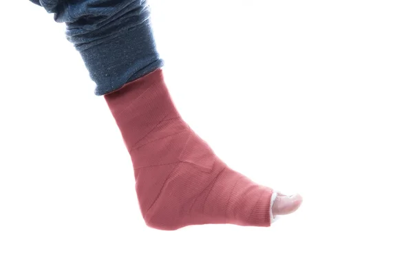 Red leg cast — Stock Photo, Image