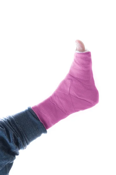 Pink leg cast — Stock Photo, Image