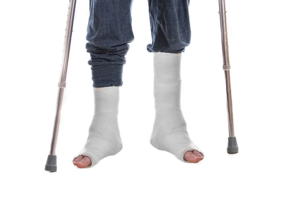 Two white leg casts and crutches — Stock Photo, Image