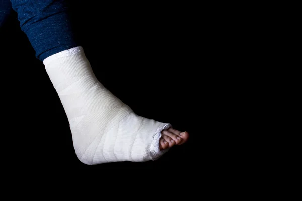 White leg cast — Stock Photo, Image