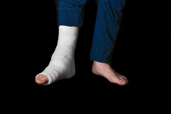 White leg cast — Stock Photo, Image