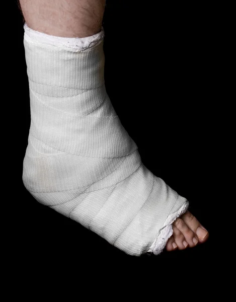 White leg cast — Stock Photo, Image