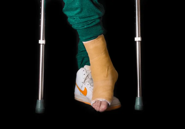 Young man with a broken ankle and a leg cast — Stock Photo, Image