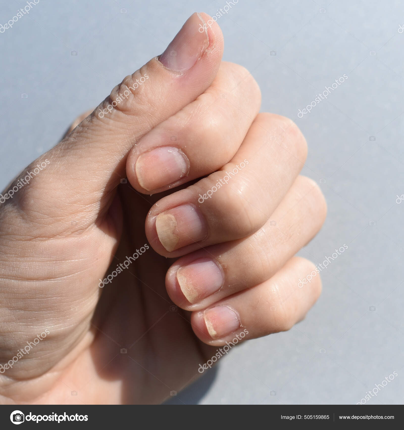 először finger nail gomba