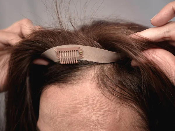 Demonstrating How Fix Toupee Hiar Extension Woman Scalp Wig Clip — Stock Photo, Image