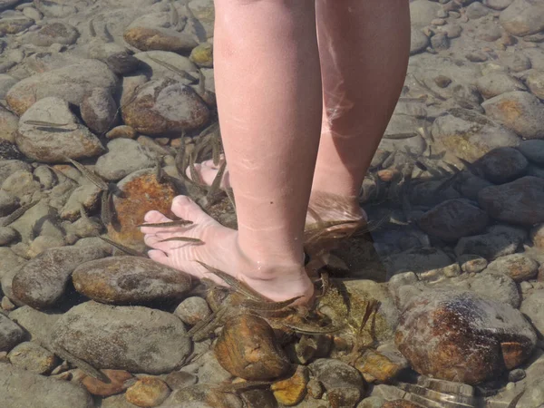 Peixes Nas Baleias Rio Siberiano Mordem Pessoas Pés Como Garra — Fotografia de Stock